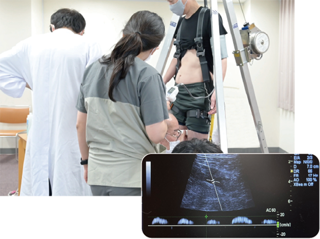血流測定画面（吊り下がり状態の大腿静脈）